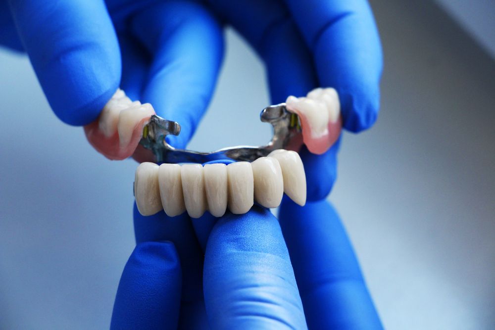 A Person Wearing Blue Gloves Is Holding A Dental Bridge In Their Hands — Mittagong Dental Care In Mittagong, NSW