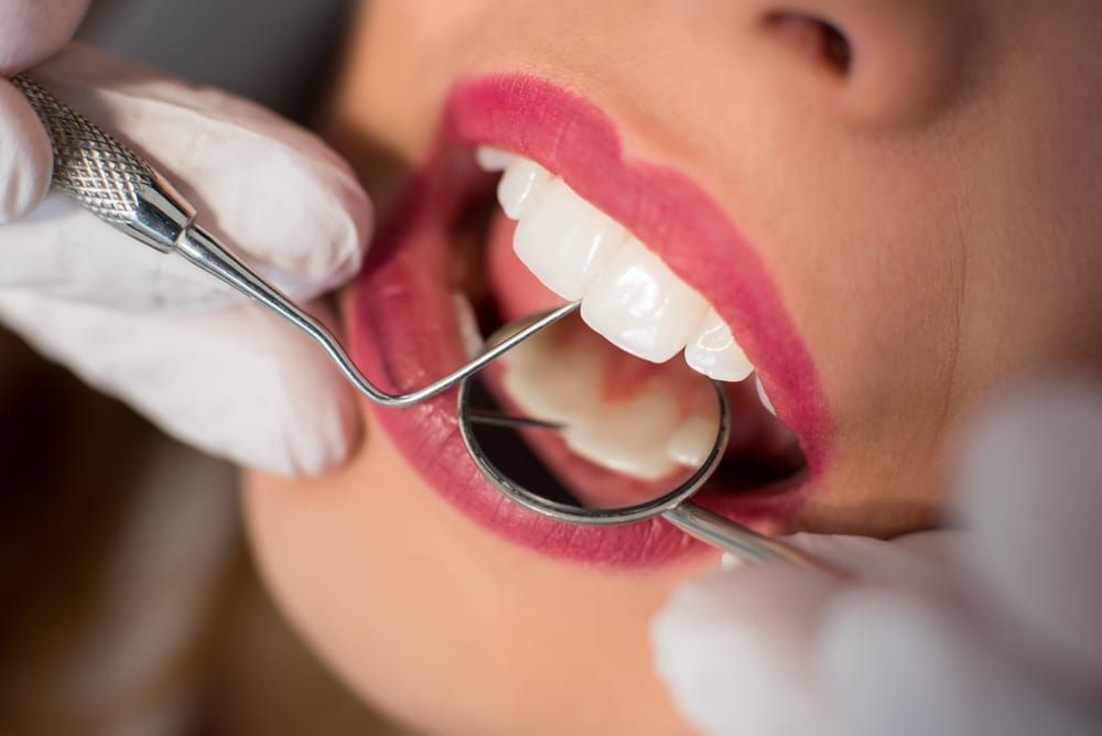 A Woman Is Getting Her Teeth — Mittagong Dental Care In Mittagong, NSW