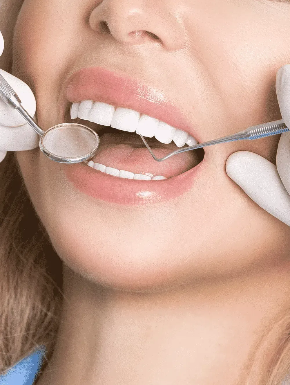 A Woman Is Getting Her Teeth Examined By A Dentist — Mittagong Dental Care In Mittagong, NSW