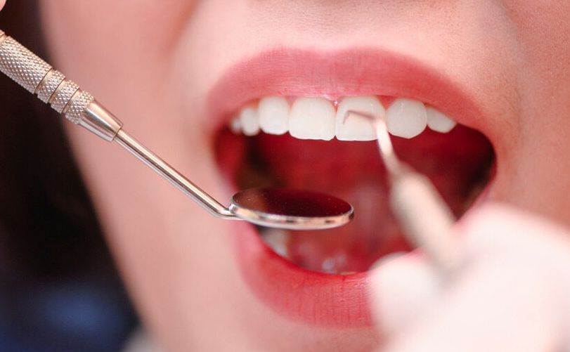 A Woman Is Getting Her Teeth Examined By A Dentist — Mittagong Dental Care In Mittagong, NSW