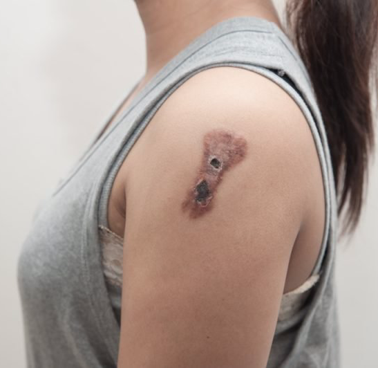 Uma mulher tem uma tatuagem de um ursinho de pelúcia no ombro
