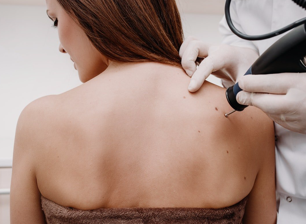 Uma mulher está fazendo um tratamento a laser nas costas.