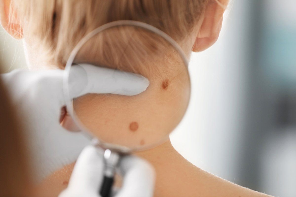 Um médico examina a pele de uma mulher com uma lupa.