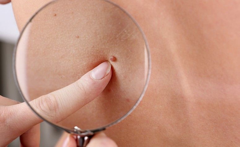 Uma pessoa está olhando para uma toupeira com uma lupa.