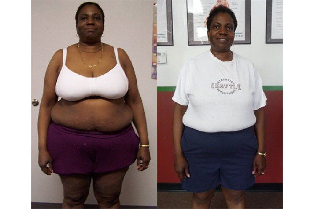weight loss