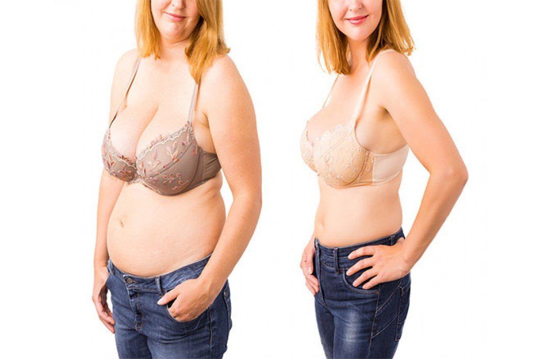 before and after