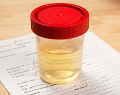 Drug Testing — Urine Sample On Cup in Gastonia, NC