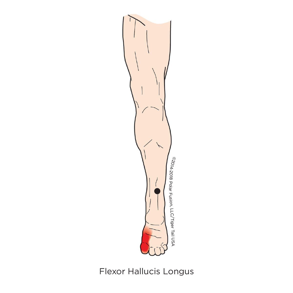 A drawing of a person 's leg with a red spot on the foot.