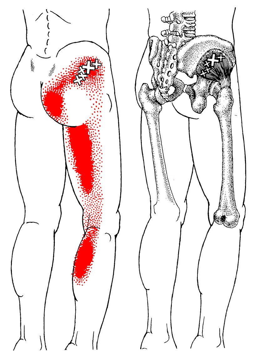 A black and white drawing of a person 's leg with a red spot on it.