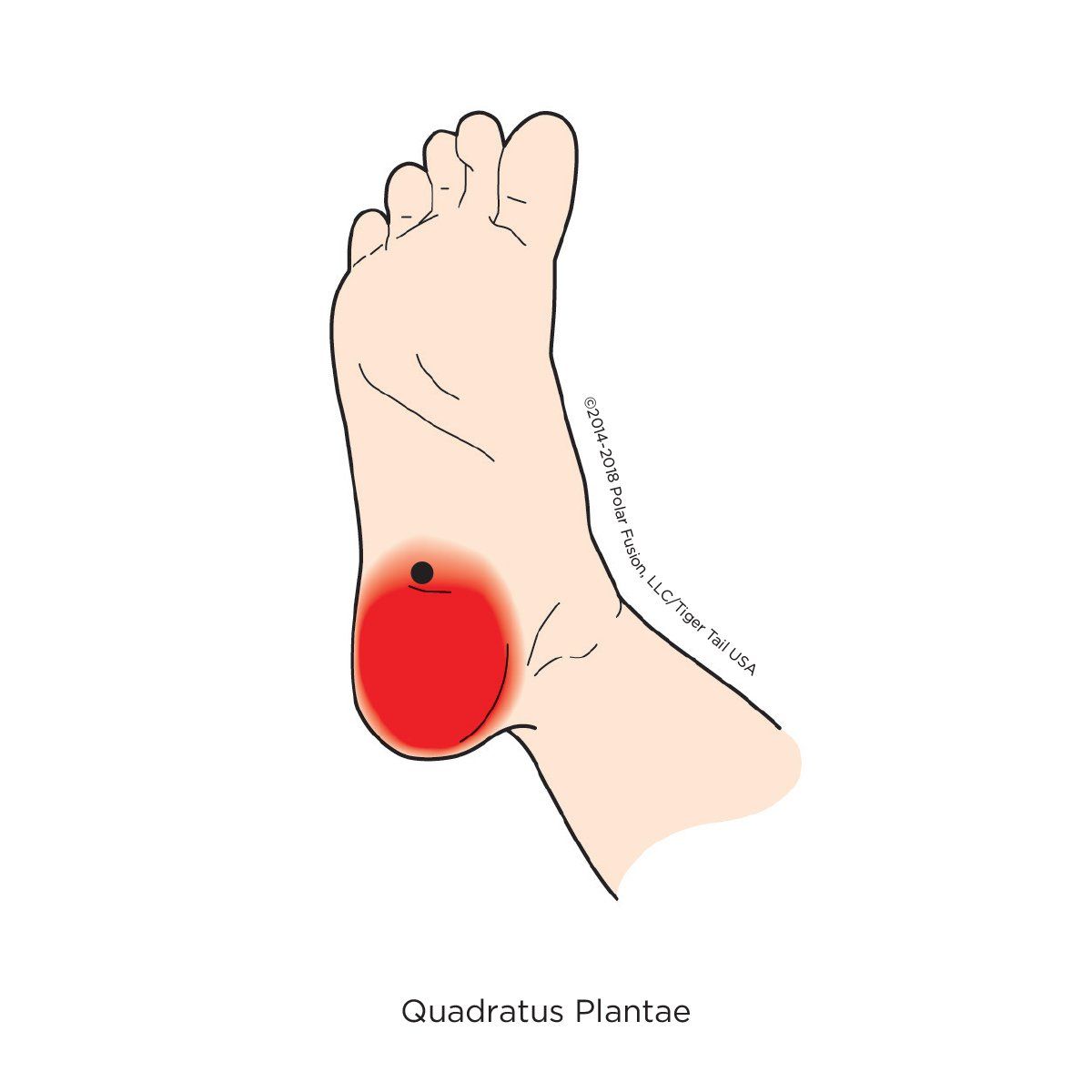 A drawing of a person 's foot with a red spot on it.