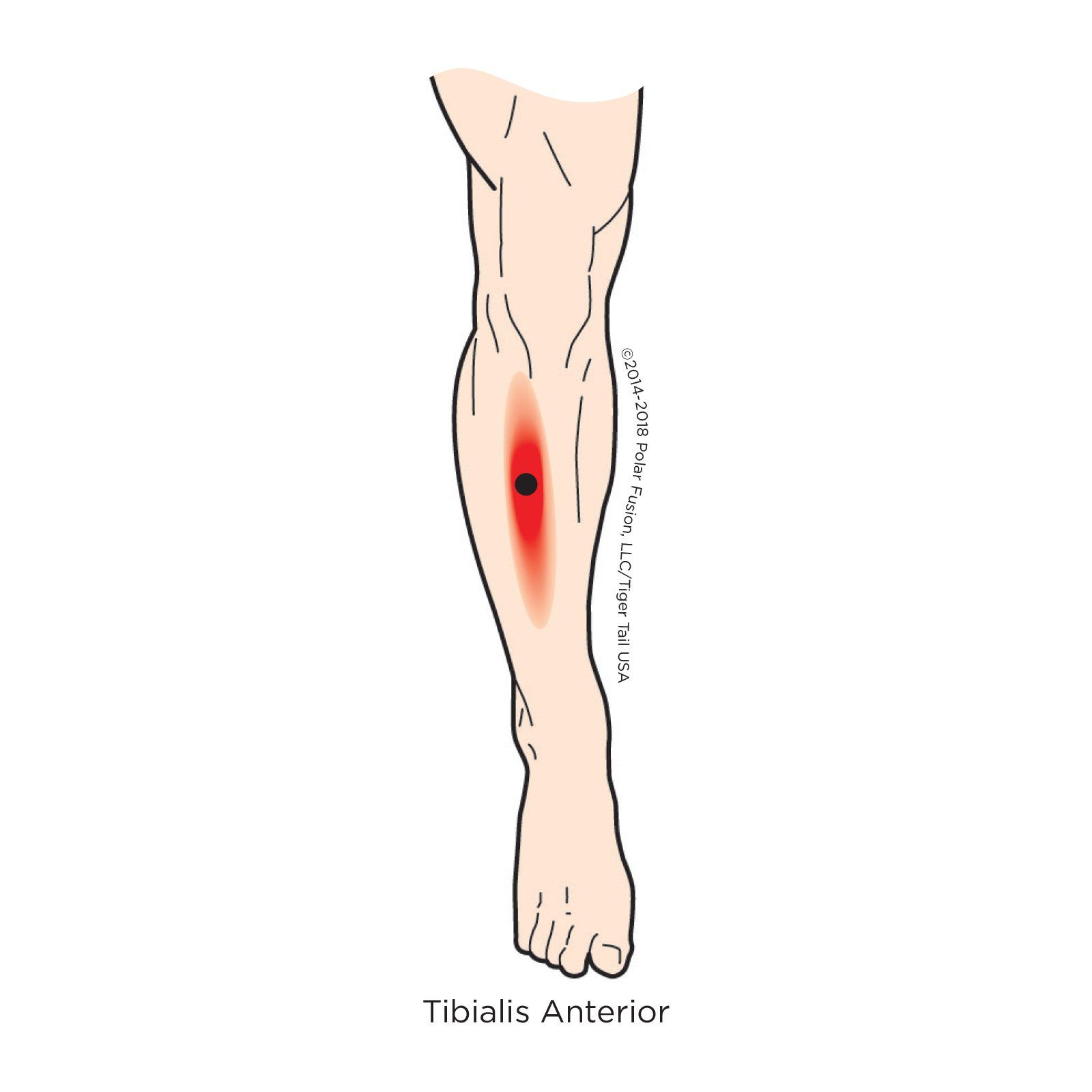 A drawing of a person 's leg with a red spot on it.