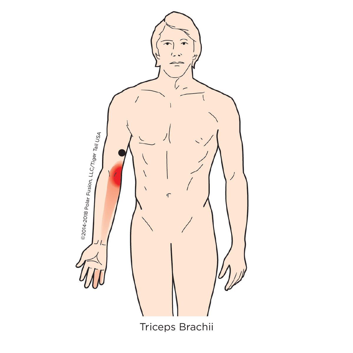 A drawing of a man with a red spot on his forearm.
