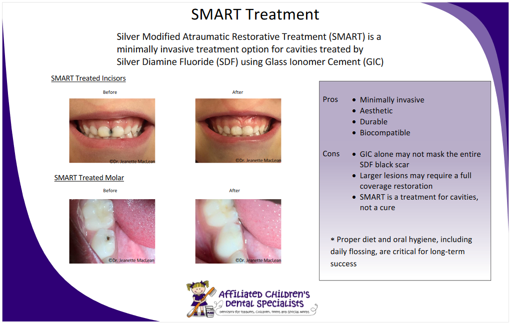 SMART Treatment ─ Flossmoor, IL ─ Pediatric Dental Specialty Associates