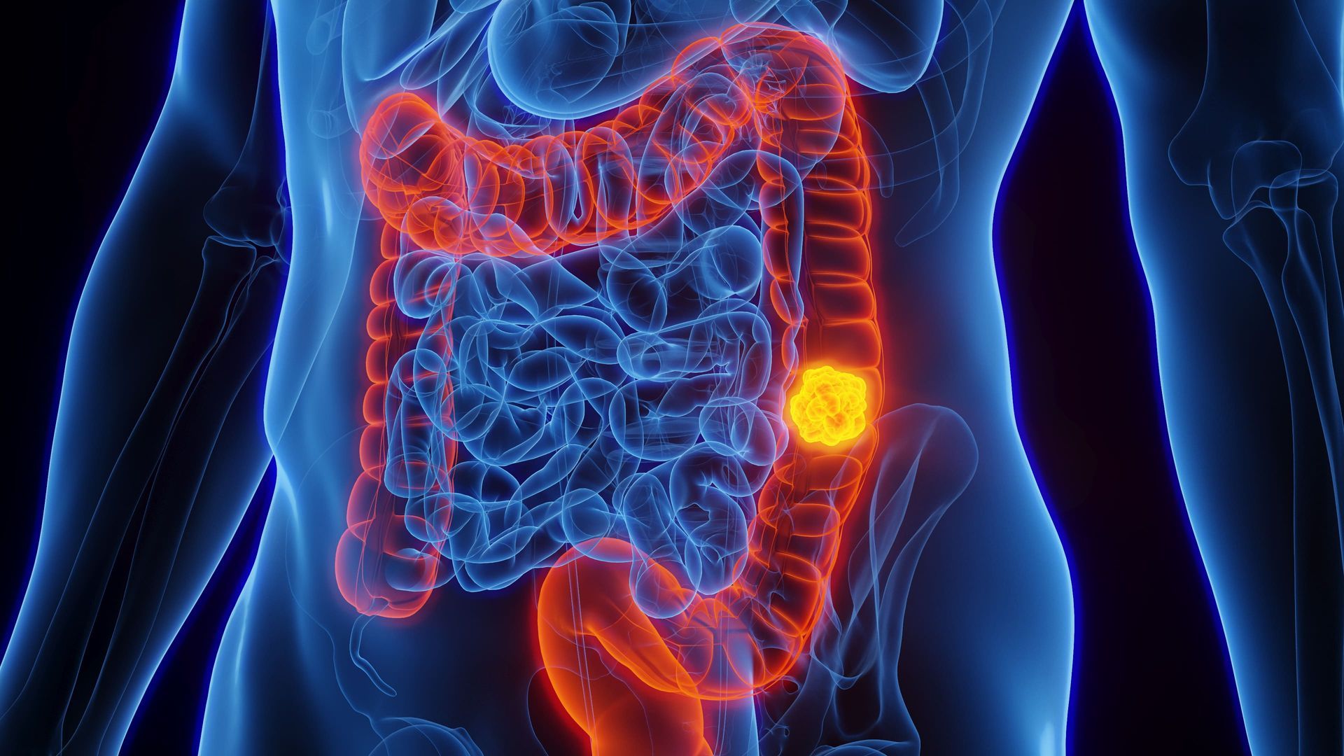 A computer generated image of a person 's stomach and large intestine.