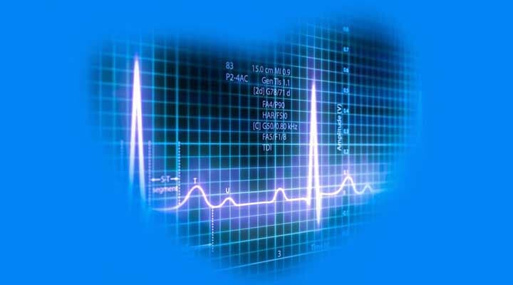 DR. JOSÉ R. AMAVIZCA MARTÍNEZ CLÍNICA CARDIOVASCULAR -   Chequeo completo