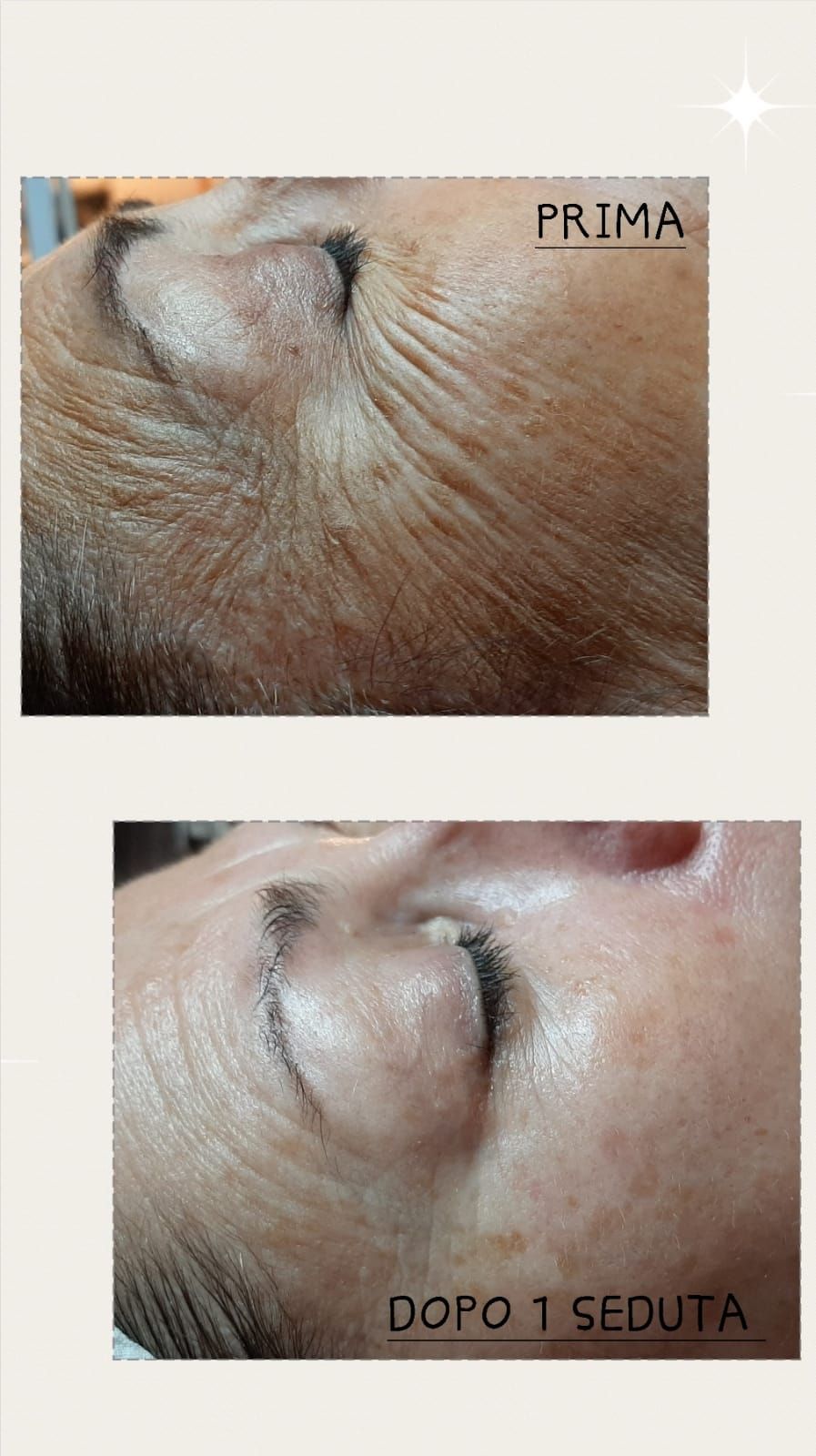 rassodamento pelle viso