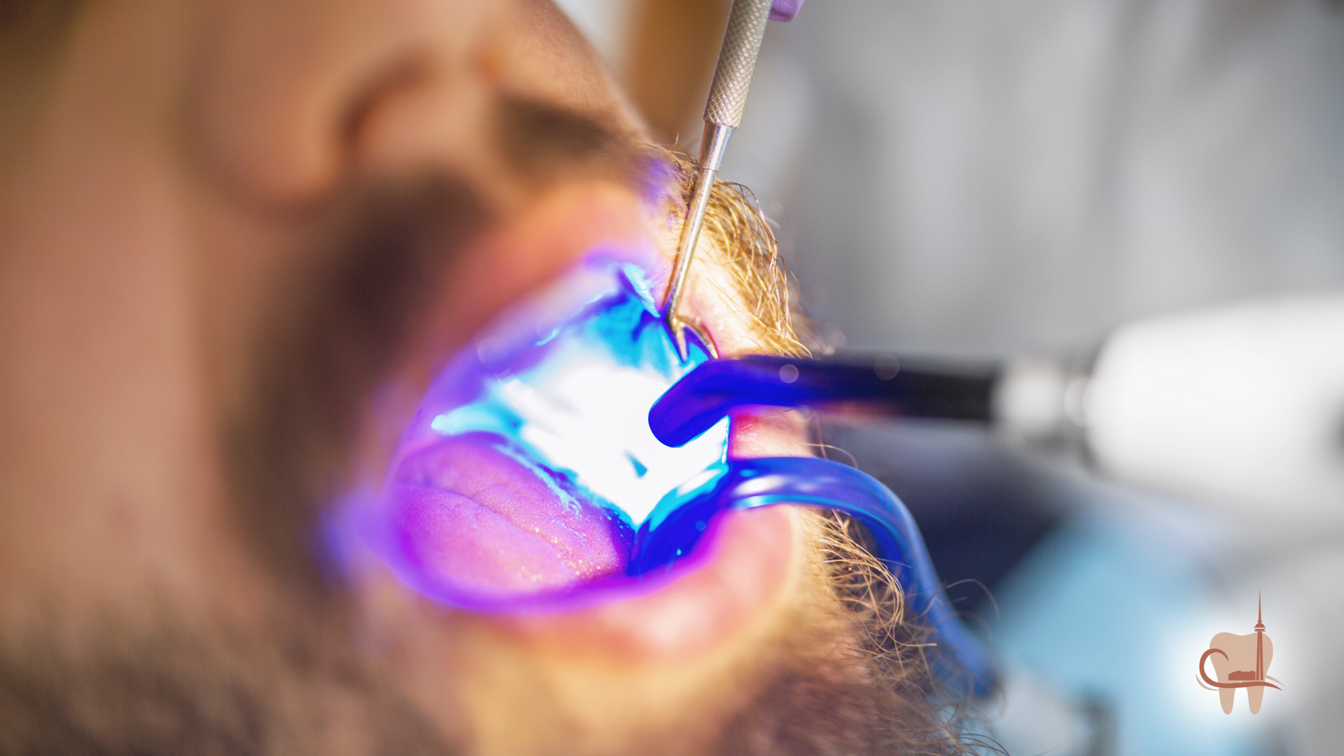 Dentist using blue curing light on patient's teeth; close-up of mouth, dental tools, blurred background.