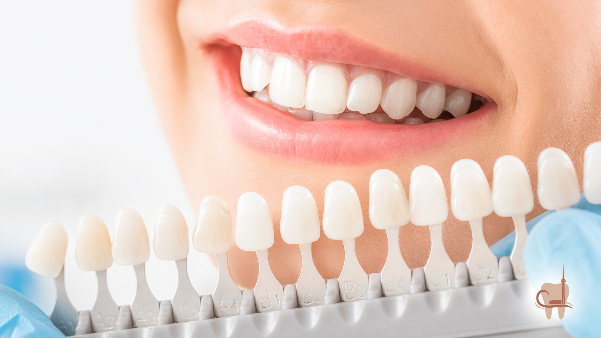 Person smiling with white teeth, comparing shade to a dental color chart.