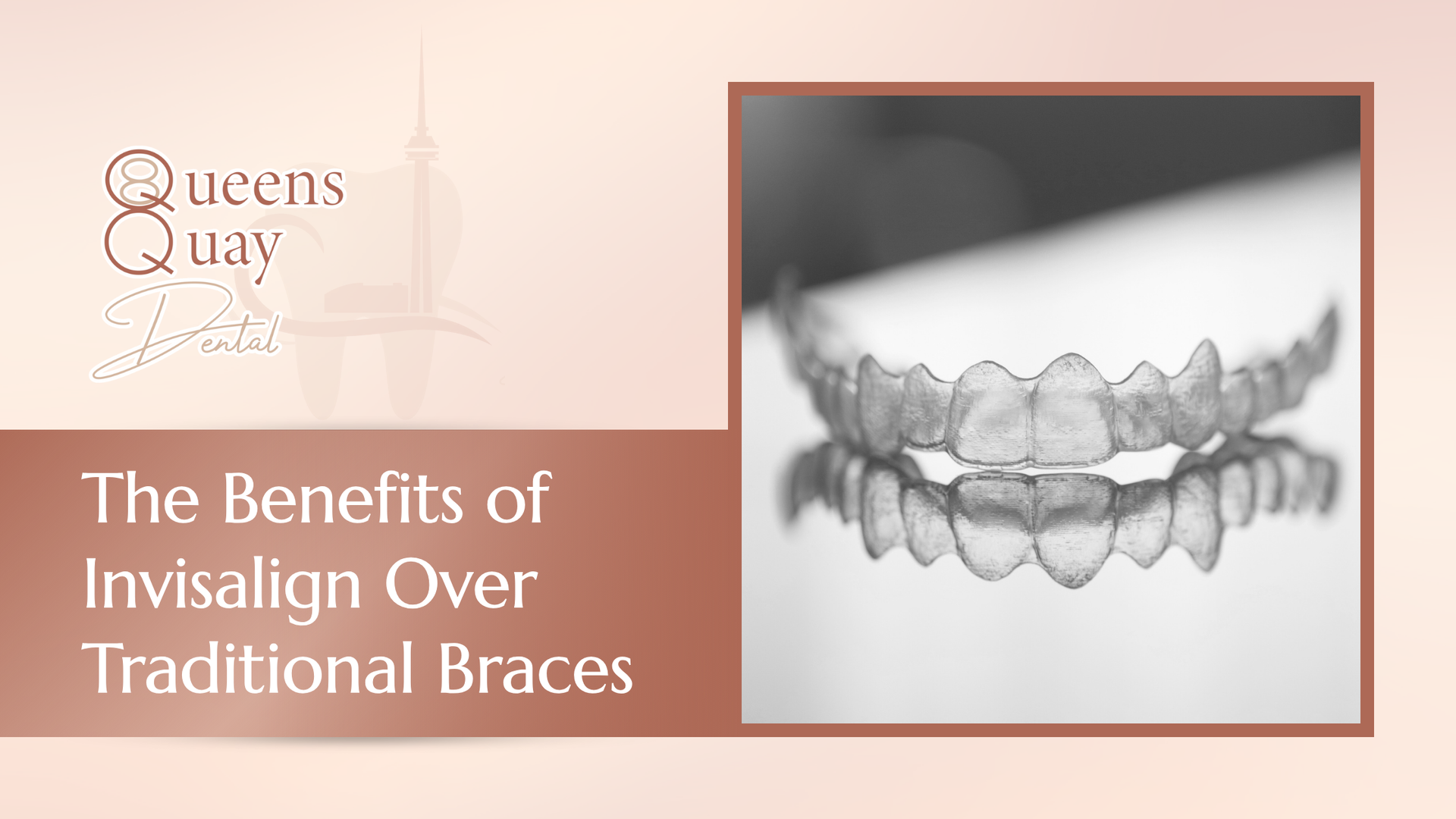 Invisalign aligners in a dental setting, with text about their benefits.
