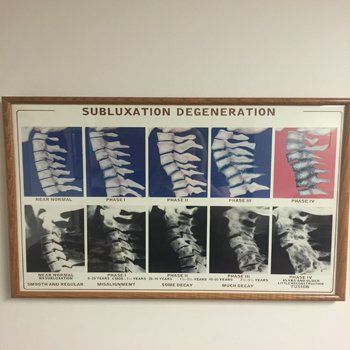 Subluxation Degeneraton - Chiropractic Services in Pittsburgh, PA