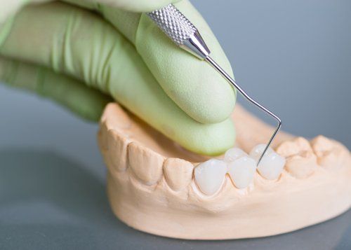 Crowns — Hand of Dentist Holding Dental Gypsum Models in Jasper, IN