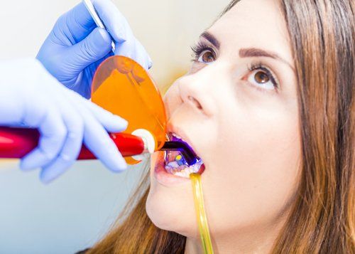 Dental Bonding — Patient Having Dental Treatment in Jasper, IN