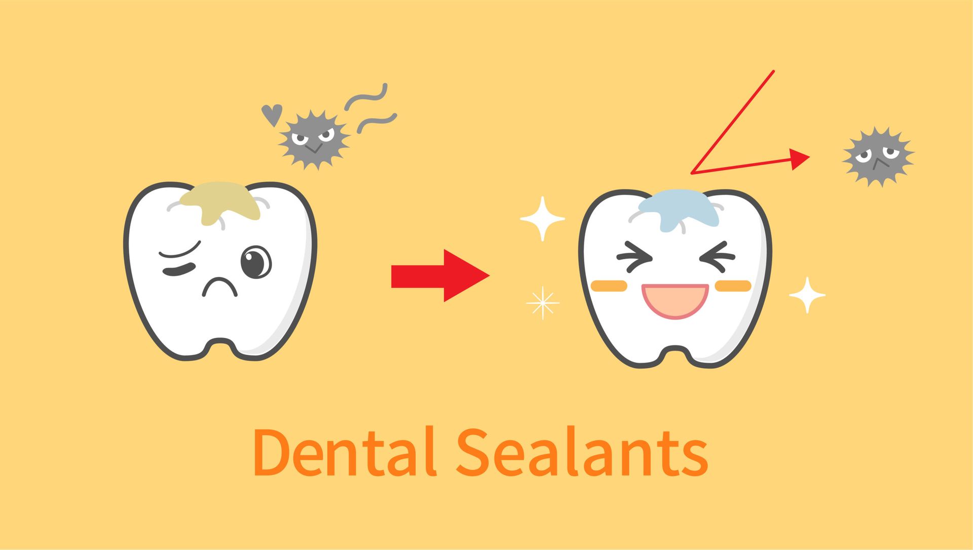 Sealants Prevent Tooth Decay