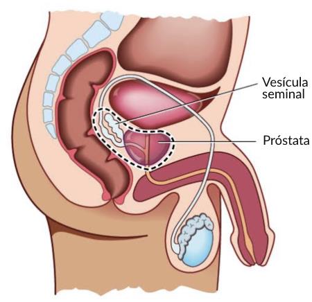 Vesícula seminal y Próstata