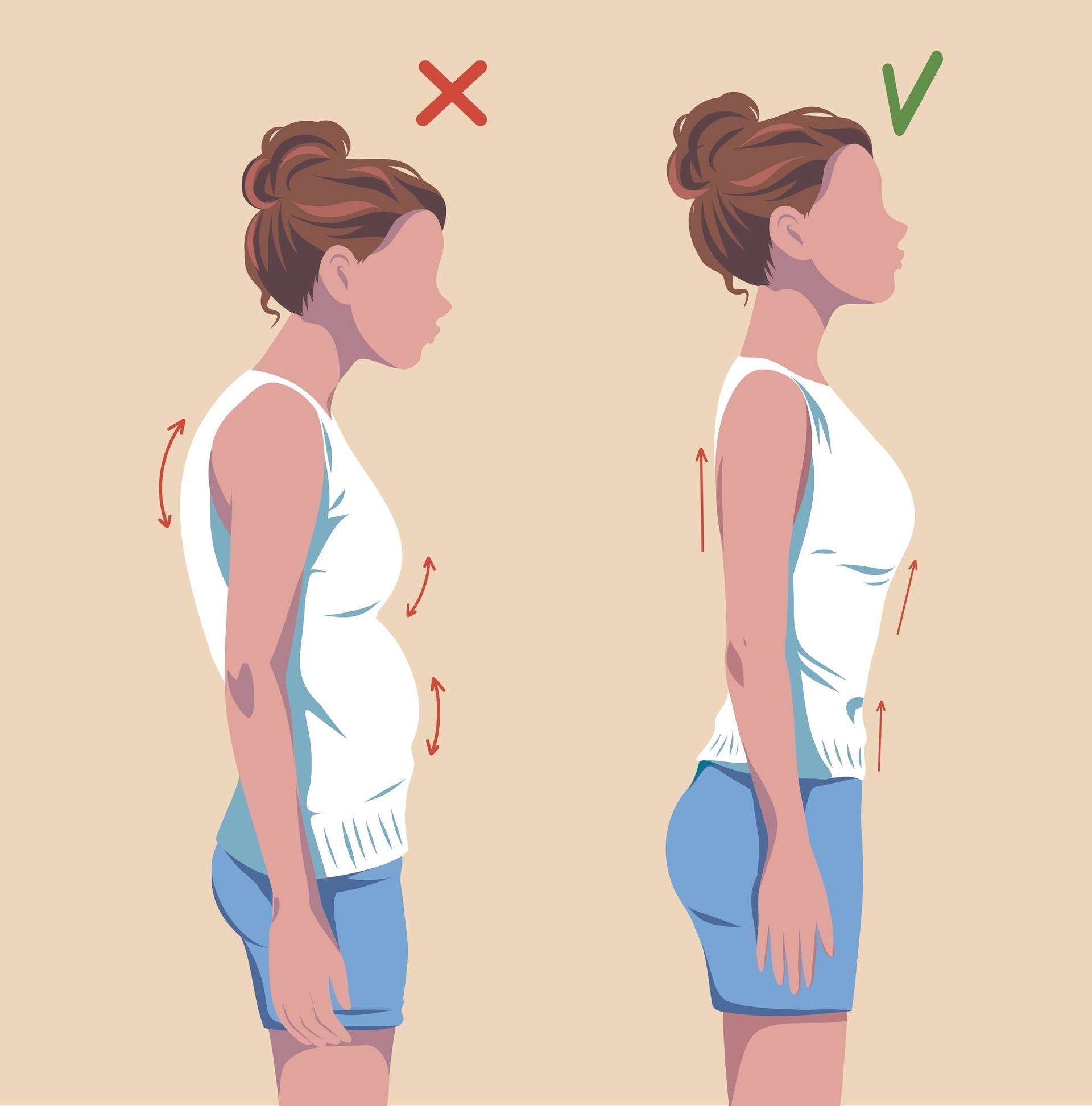 Posture Correction Therapy