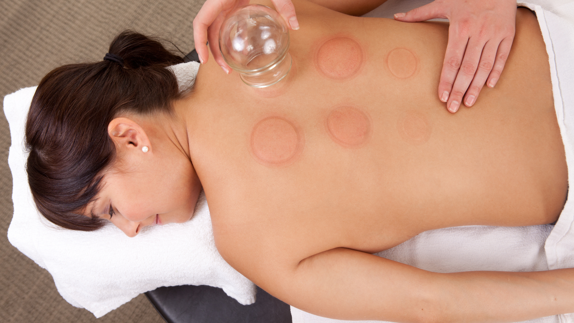 Cupping Therapy