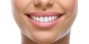 Periodontics — Orthodontic Bracket or Brace in Lexington, KY