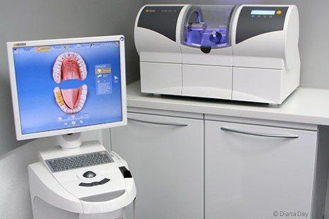 Am Computer konstruiert und innerhalb weniger Minuten wird aus einem Keramikblock das Inlay geschliffen und kann sofort eingesetzt werden. Am Computer konstruiert und innerhalb weniger Minuten wird aus einem Keramikblock das Inlay geschliffen und kann sofort eingesetzt werden.