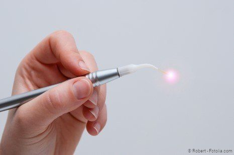 Dental-Laser: nahezu schmerzfrei und weitgehend unblutig Dental-Laser: nahezu schmerzfrei und weitgehend unblutig