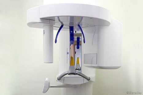 Weniger Strahlenbelastung mit digitalem Röntgen Weniger Strahlenbelastung mit digitalem Röntgen