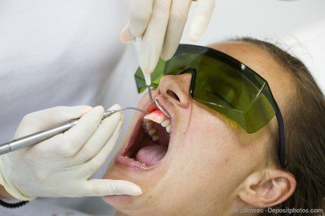 Behandlung von Parodontitis per Dental-Laser Behandlung von Parodontitis per Dental-Laser