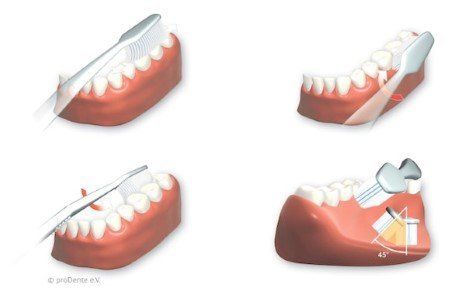 Einfach zu erlernen: Die KAI-Putztechnik!