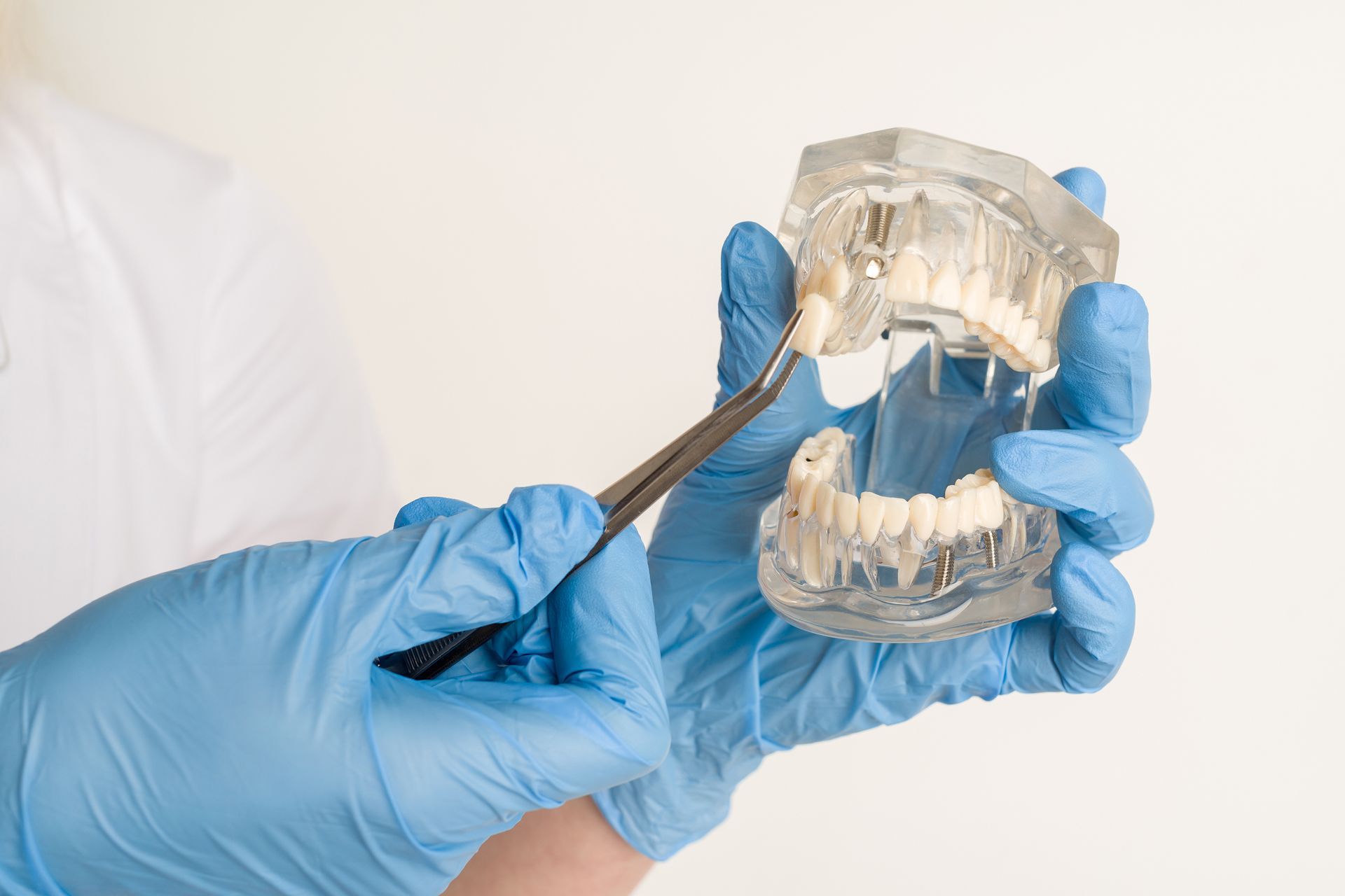 A dentist is holding a model of a person 's teeth with tweezers.