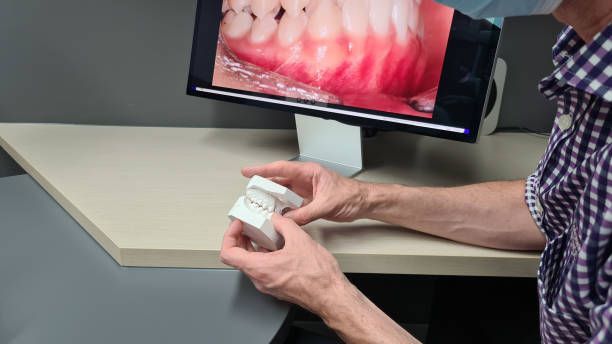 A man is holding a model of his teeth in front of a computer screen.