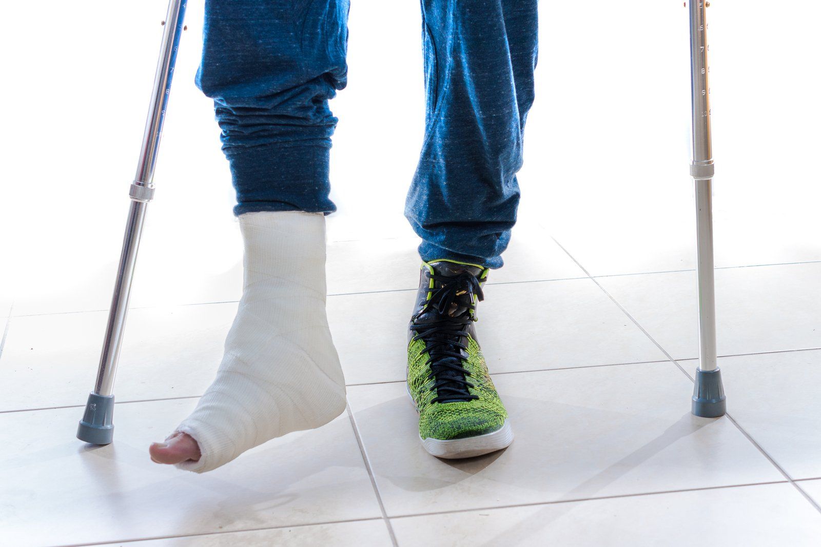 cast foot with crutches  image
