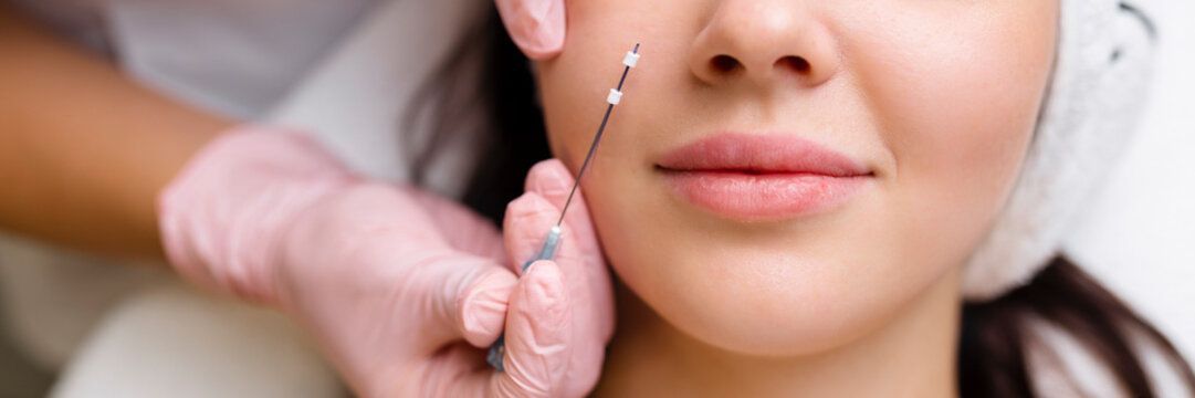 micro needling
