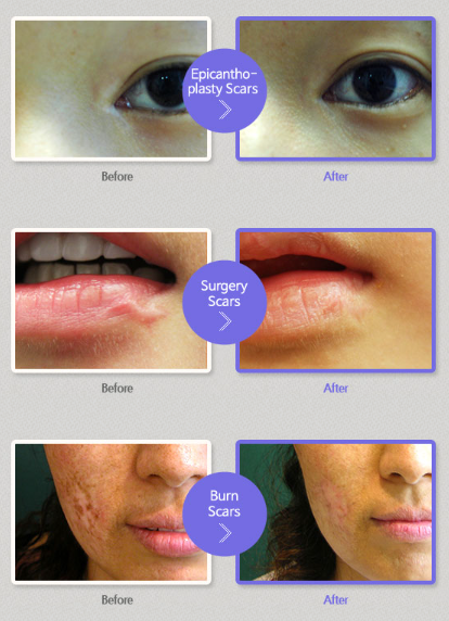 A woman 's face is shown before and after surgery
