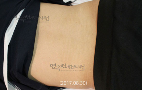 A close up of a person 's stomach with the date 2017 08 30