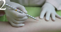 A person is holding a pen over a person 's arm.