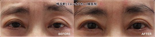 A before and after photo of a woman 's eyes
