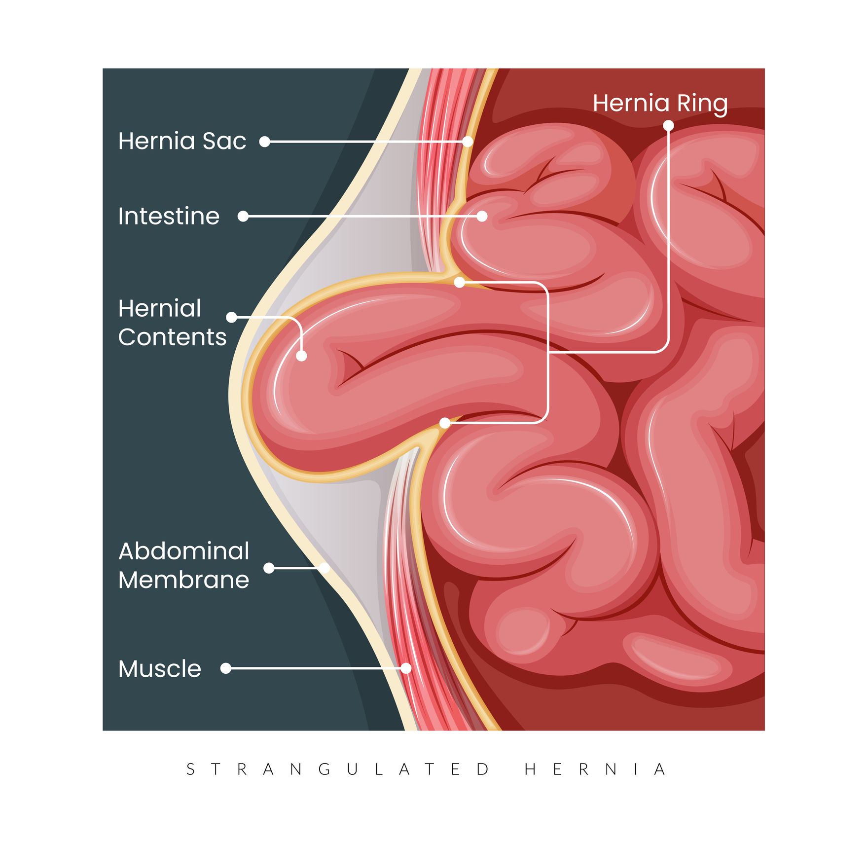 Two surgeons are looking up at a light in an operating room.