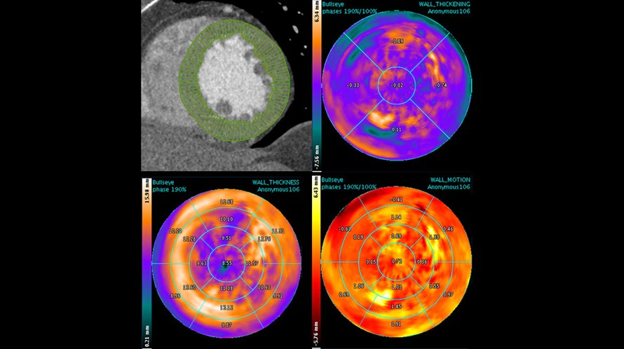 A collage of four images of a heart with different colored circles.
