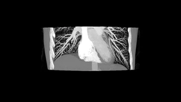 It is a black and white image of a person 's chest.