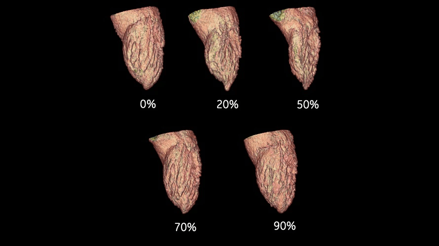 A picture of a heart with different percentages on it