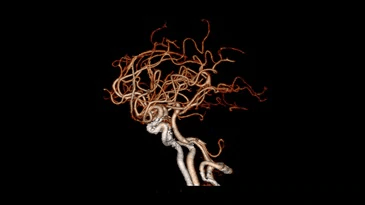 A computer generated image of a brain with a black background.