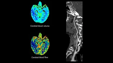 A computer-generated image of a heart with roots on a black background.